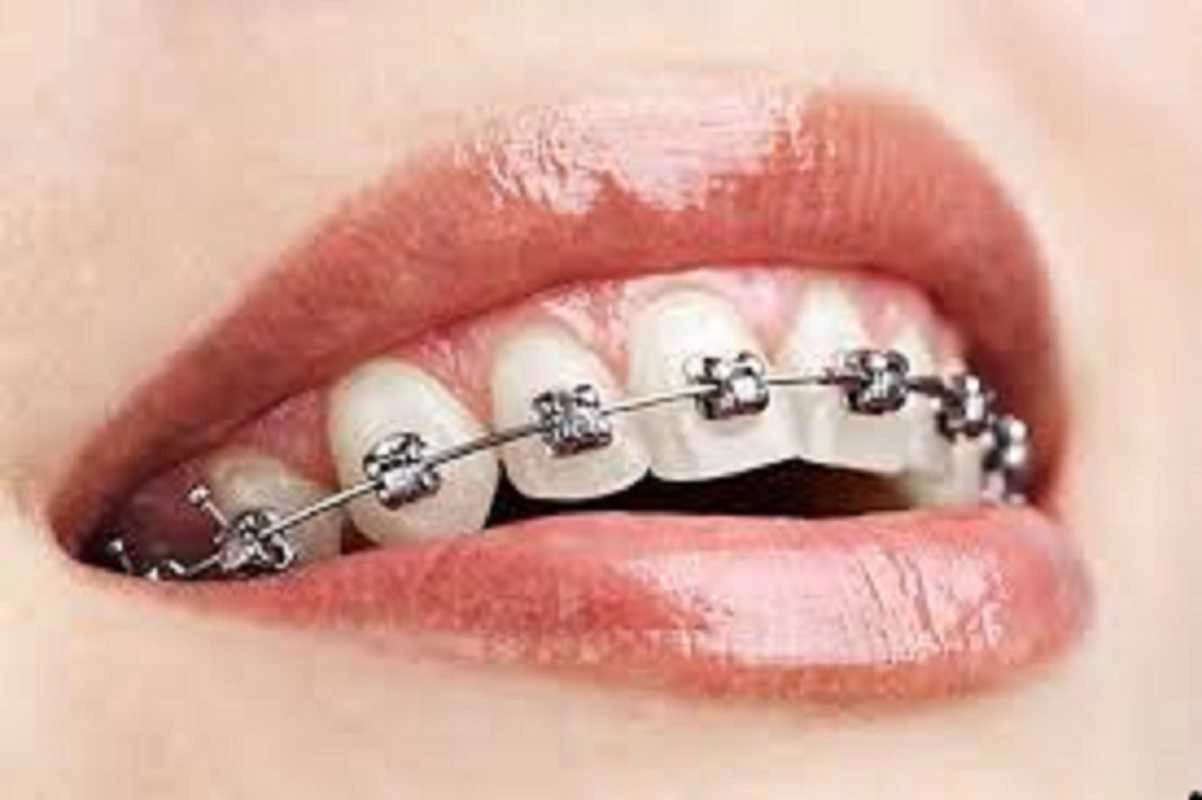 orthodontics